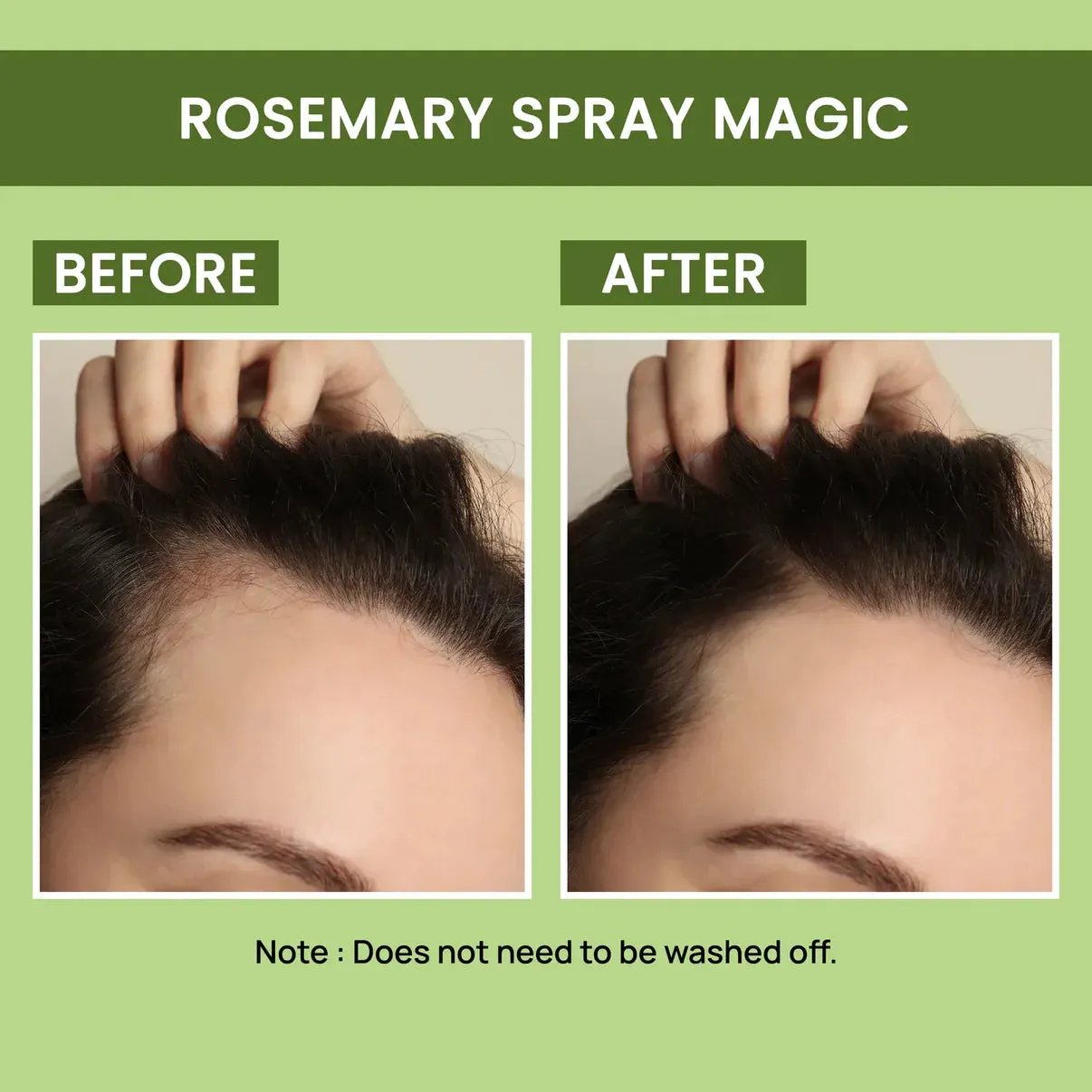 Rosemary Water, Hair Spray For Regrowth [Buy 1 Get 1 Free]